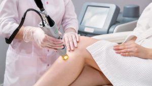 how much laser hair removal cost